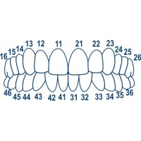 №1.910 Матрицы \\"колпачки\\" для фронтальных зубов